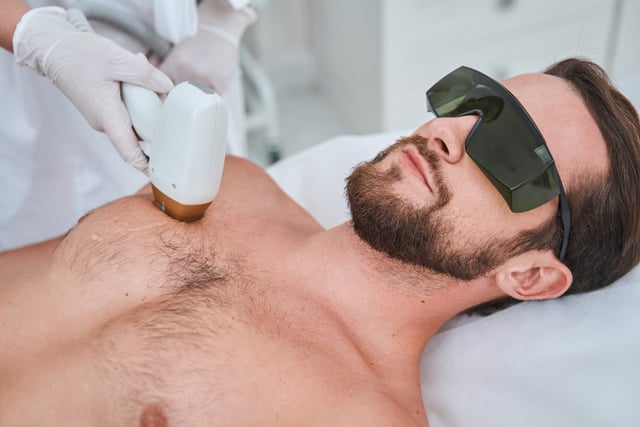 large area laser hair removal