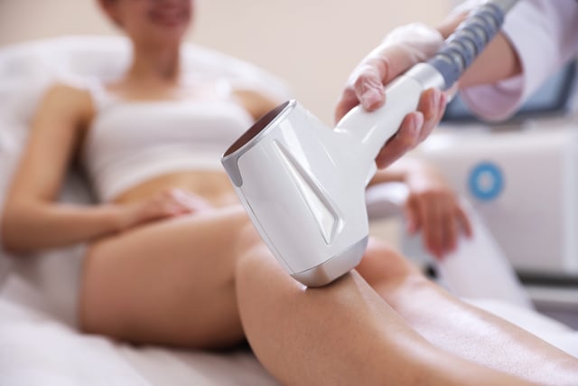 medium area laser hair removal