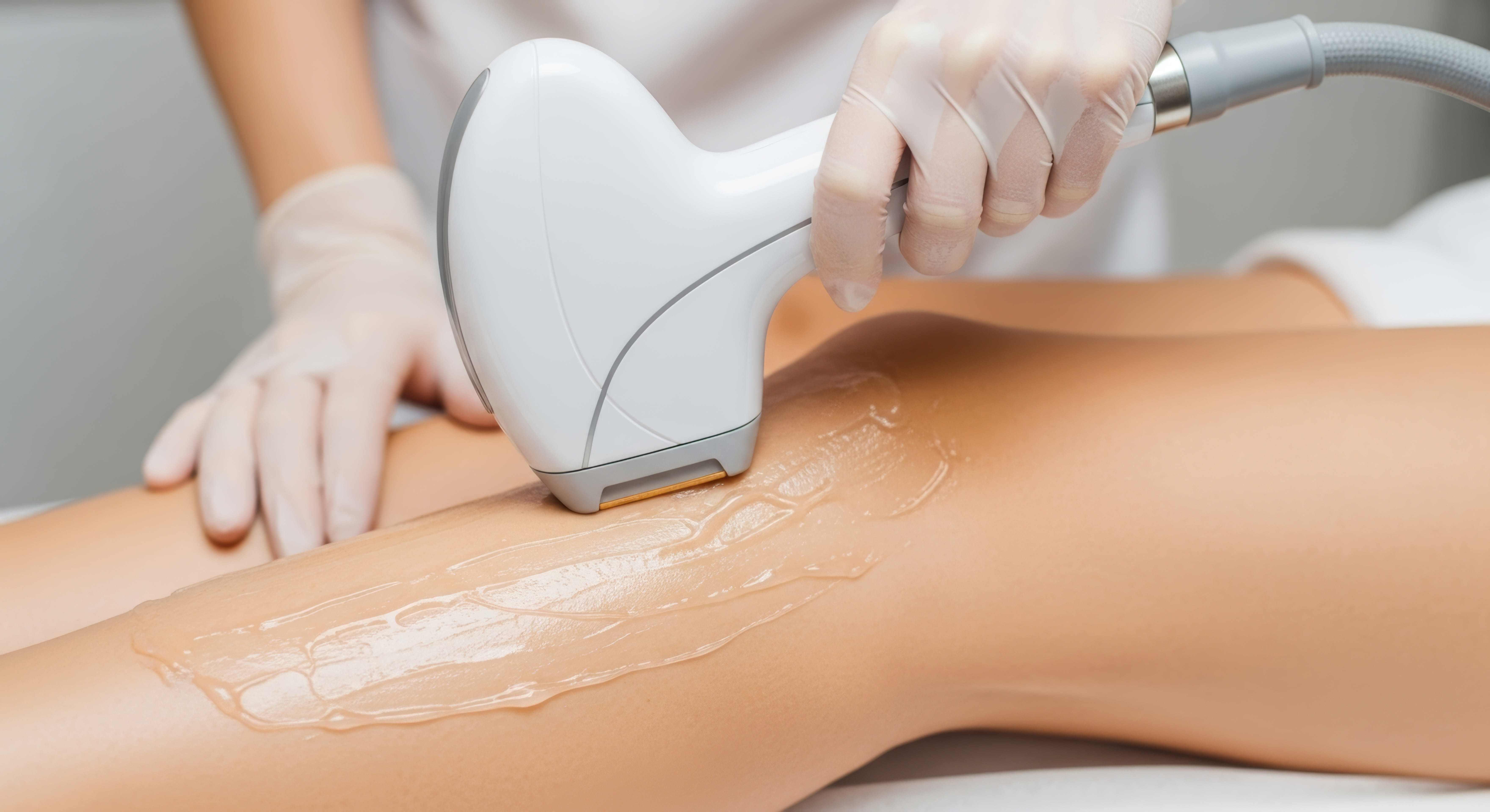 summer laser special full legs brazilian underarms treatment